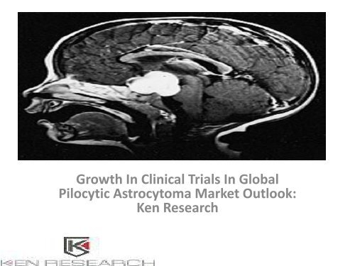 Global Pilocytic Astrocytoma Market Research Report, Analysis, Opportunities, Forecast, Size, Segmentation, Competitive Analysis : Ken Research