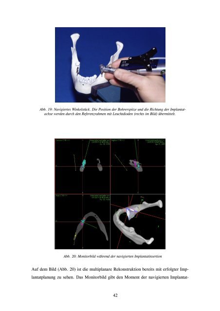 Image Guided Surgery - Technische Universität Dresden