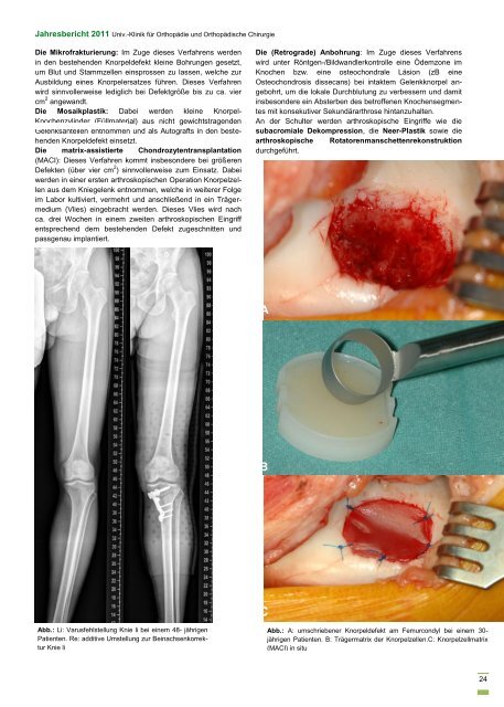 Jahresbericht 2011 - Universitätsklinik für Orthopädie und ...