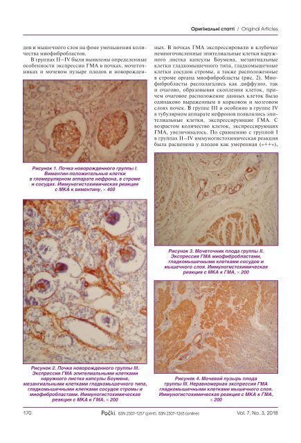 Журнал "Почки" том 7, №3 (2018г.)