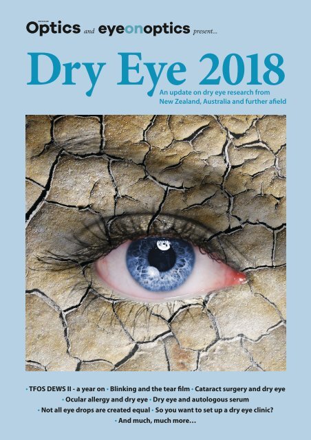 Dry Eye 2018