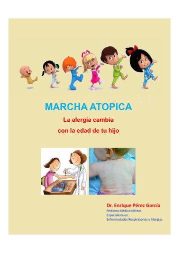 Marcha Atopica "El camino hacia la alergia"