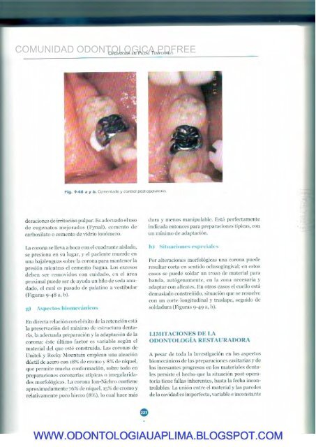 Odontologia Pediatrica - Fernando Escobar