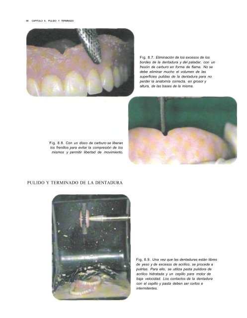 PROSTODONCIA FINAL