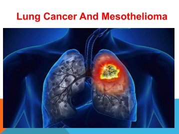 Lung Cancer And Mesothelioma Causes