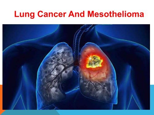 Lung Cancer And Mesothelioma Causes