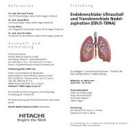 aspiration (EBUS-TBNA) - Hitachi Medical Systems