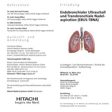 aspiration (EBUS-TBNA) - Hitachi Medical Systems