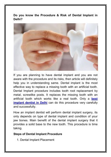 Do you know the Procedure & Risk of Dental Implant in Delhi