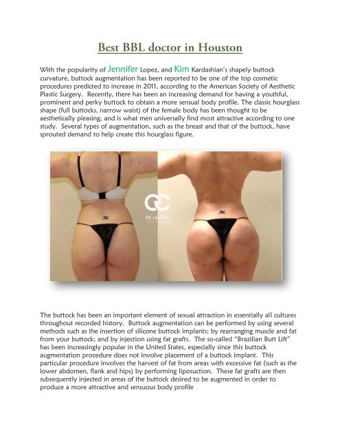 Best brazilian butt lift in beverly hills