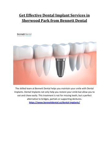 Get Effective Dental Implant Services in Sherwood Park from Bennett Dental