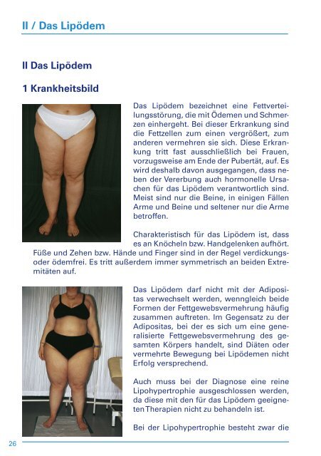 Informationsbroschuere Lymphoedem