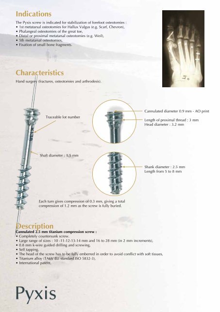 Metatarsal osteotomy - Int2Med