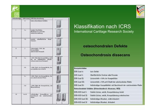 Kniebinnenschäden Kniebinnenschäden - Sportklinik Halle