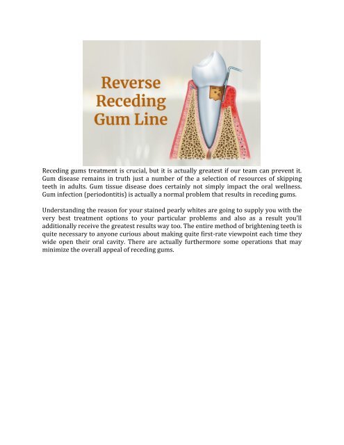 Toothpaste For Receding Gums 