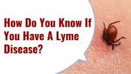 How Do You Know If You Have A Lyme Disease