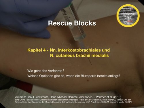 Rescue Blocks_Kapitel_4_Nn. interkostobrachiales et cut. brachii medialis