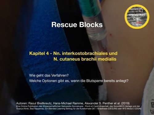 Rescue Blocks_Kapitel_4_Nn. interkostobrachiales et cut. brachii medialis