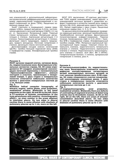 9_Актуальные вопросы современной клинической медицины с обл