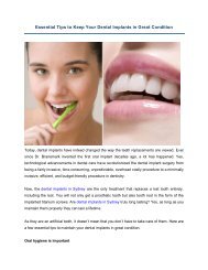 Essential Tips to Keep Your Dental Implants in Great Condition