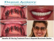 Benefits Of Having Treatment From A Reputed Biomimetic Dentist