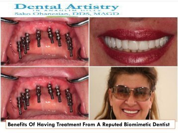 Benefits Of Having Treatment From A Reputed Biomimetic Dentist