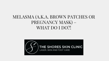 skinclinic- treat Melasma