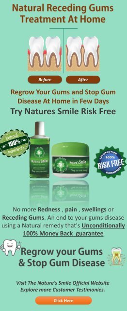 Natural Receding Gums Treatment