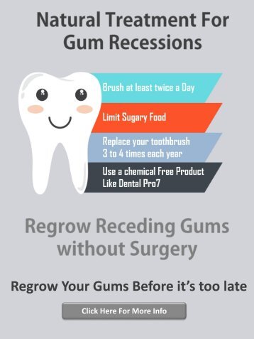 Gum Recession Treatment Options