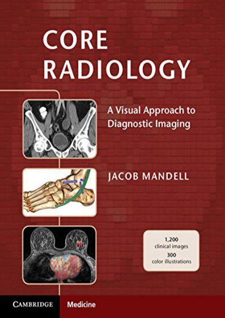 Ebooks download Core Radiology: A Visual Approach to Diagnostic Imaging  [DOWNLOAD] 