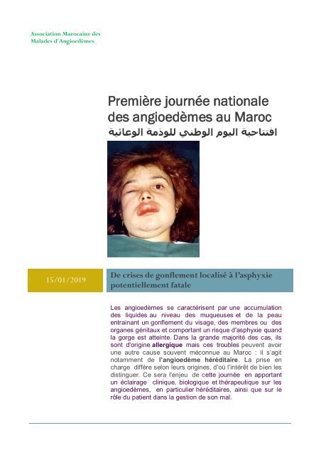 Première journée nationale des Angioedèmes au Maroc