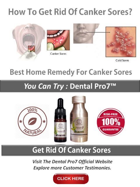 How To Treat Canker Sores