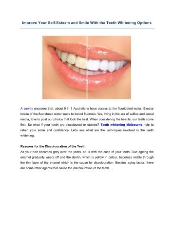 Improve Your Self-Esteem and Smile With the Teeth Whitening Options