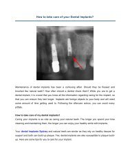 How to take care of your Dental Implants?