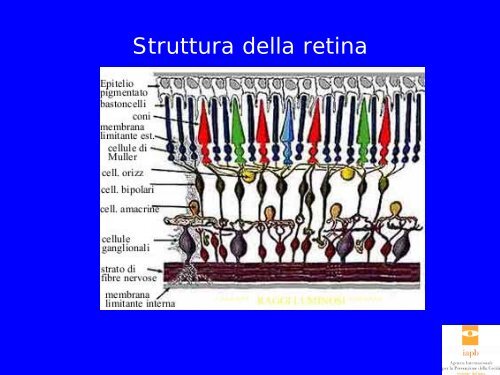 retina