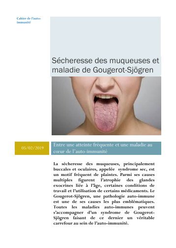 Sécheresse des muqueuses et maladie de Gougerot-Sjögren au Maroc