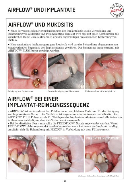 EMS_GA_AIRFLOW PROPHYLAXIS MASTER