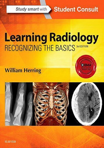 [+][PDF] TOP TREND Learning Radiology: Recognizing the Basics, 3e  [FULL] 