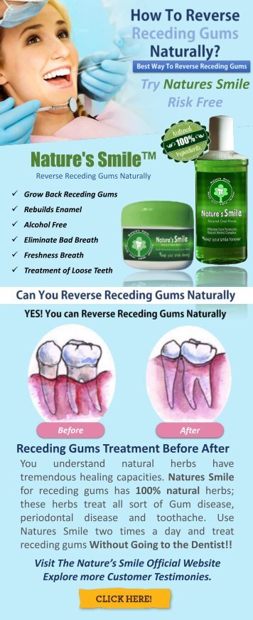 Reverse Receding Gums