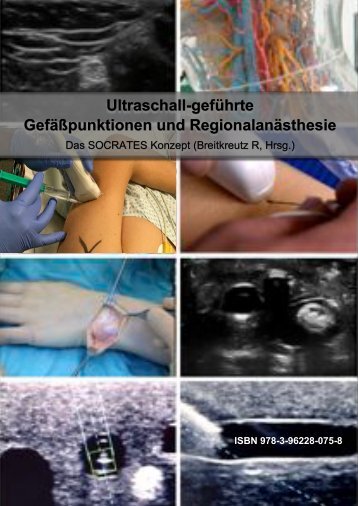 Ultraschall-geführte Gefäßpunktion und Regionalanästhesie: SOCRATES Buch Online Version