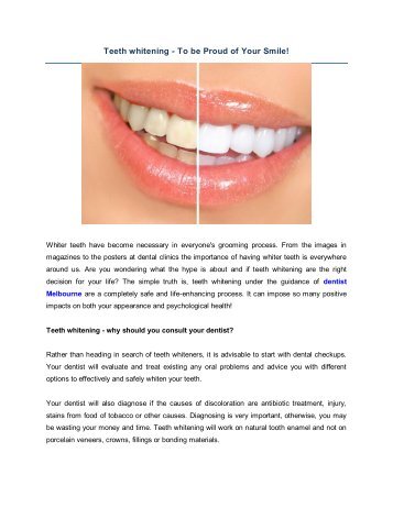 Teeth whitening - To be Proud of Your Smile!