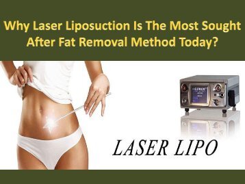 Why Laser Liposuction Is The Most Sought After Fat Removal Method Today