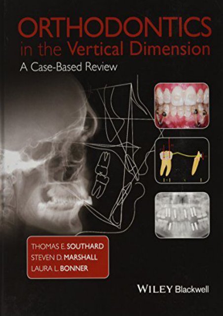 Downlaod Orthodontics in the Vertical Dimension: A Case-Based Review Epub