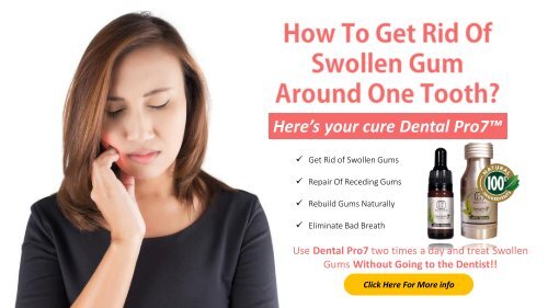 Experts Warn: Swollen Gum Around One Tooth, No Pain? Get Checked Immediately! - 85arhs6