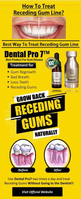 Receding Gums Treatment