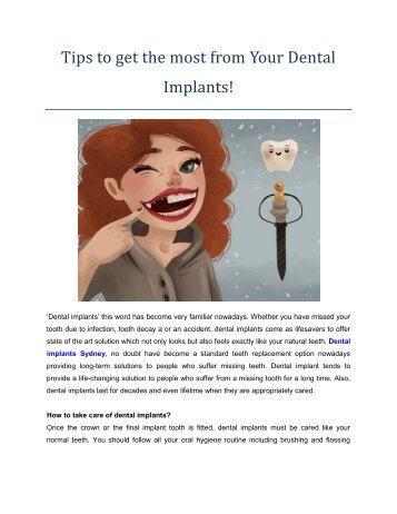 Tips to get the most from Your Dental Implants!