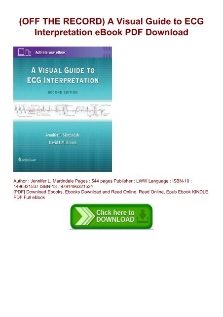 (OFF THE RECORD) A Visual Guide to ECG Interpretation eBook PDF Download