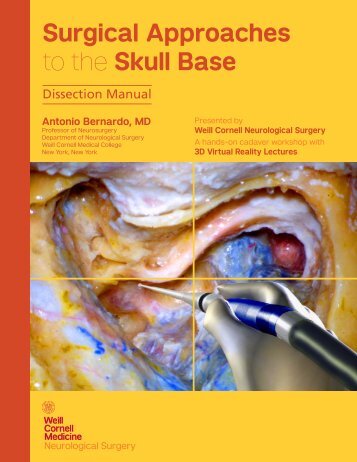 Weill Cornell Surgical Approaches to the Skull Base Dissection Manual