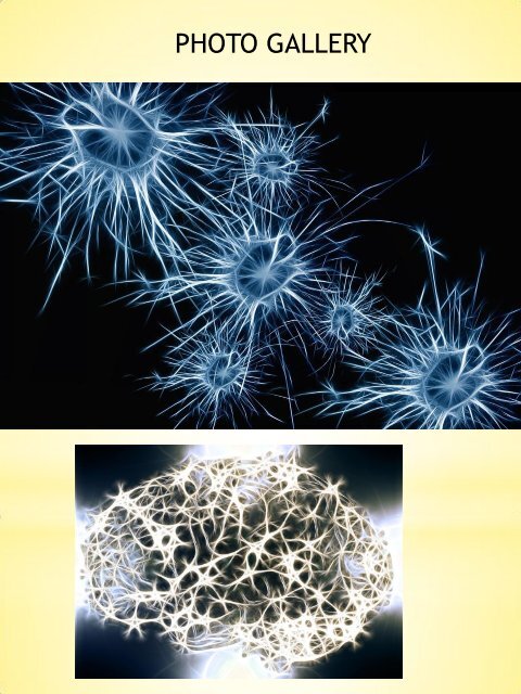 Modafinil Side Effect