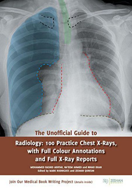 [+]The best book of the month The Unofficial Guide to Radiology: 100 ...